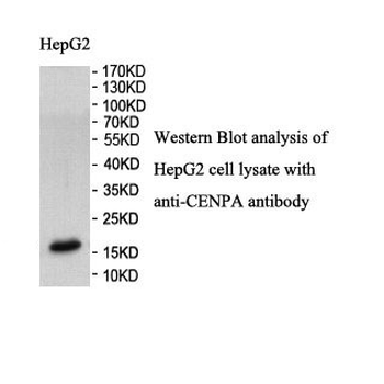 CENPA Rabbit Polyclonal Antibody