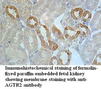 AGTR2 Rabbit Polyclonal Antibody