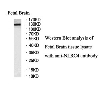 NLRC4 Rabbit Polyclonal Antibody