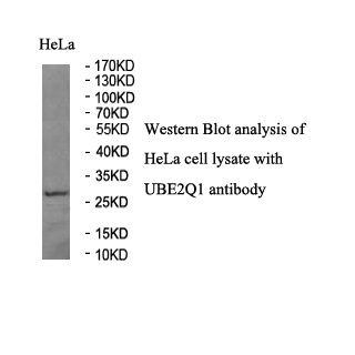 UBE2Q1 Rabbit Polyclonal Antibody