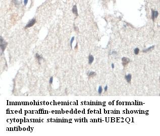 UBE2Q1 Rabbit Polyclonal Antibody