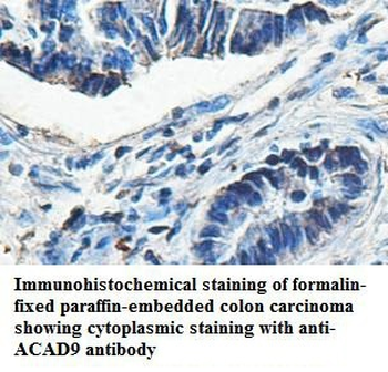 ACAD9 Rabbit Polyclonal Antibody