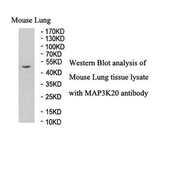 ZAK Rabbit Polyclonal Antibody