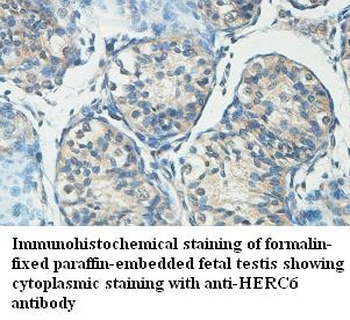 HERC6 Rabbit Polyclonal Antibody