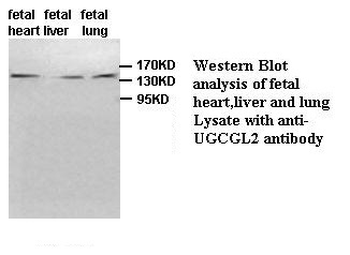 UGCGL2 Rabbit Polyclonal Antibody