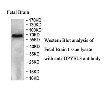 DPYSL3 Rabbit Polyclonal Antibody
