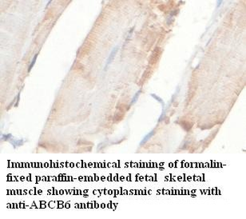 ABCB6 Rabbit Polyclonal Antibody