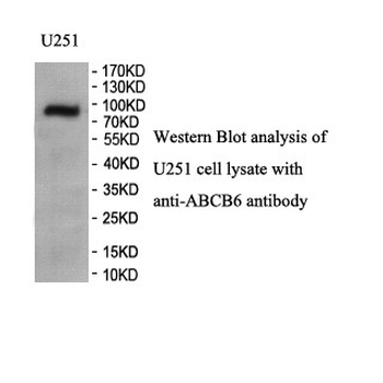 ABCB6 Rabbit Polyclonal Antibody