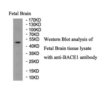 BACE1 Rabbit Polyclonal Antibody