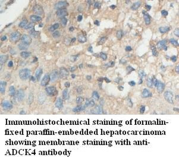 ADCK4 Rabbit Polyclonal Antibody
