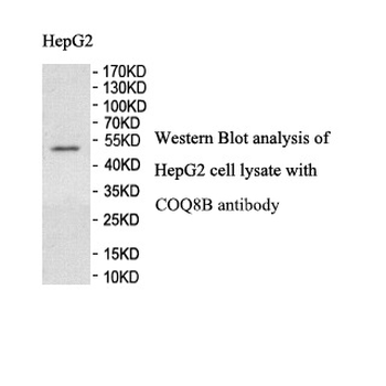 ADCK4 Rabbit Polyclonal Antibody