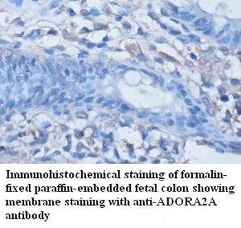 ADORA2A Rabbit Polyclonal Antibody
