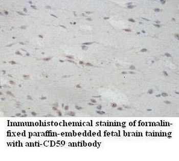 CD59 Rabbit Polyclonal Antibody