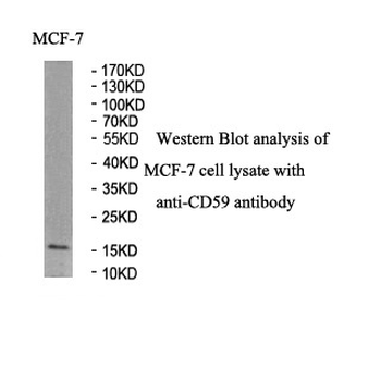 CD59 Rabbit Polyclonal Antibody