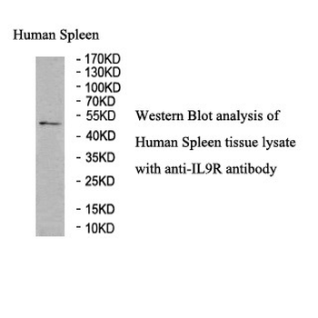 IL9R Rabbit Polyclonal Antibody