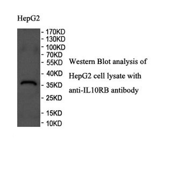 IL10RB Rabbit Polyclonal Antibody