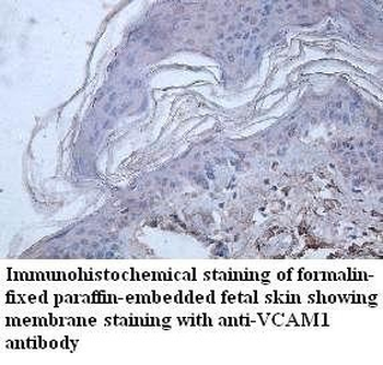 VCAM1 Rabbit Polyclonal Antibody