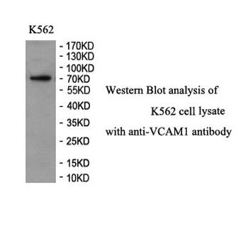 VCAM1 Rabbit Polyclonal Antibody
