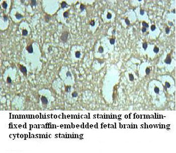 AK3L1 Rabbit Polyclonal Antibody