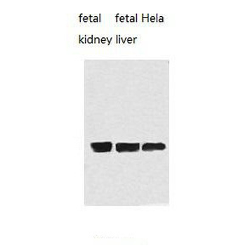 AK3L1 Rabbit Polyclonal Antibody