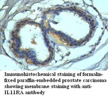 IL11RA Rabbit Polyclonal Antibody