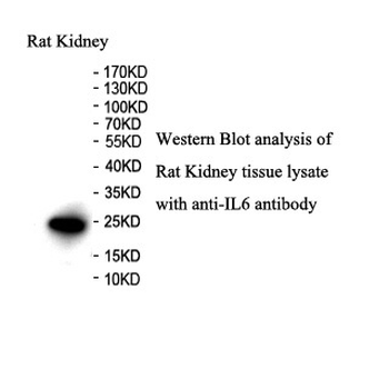 IL6 Rabbit Polyclonal Antibody