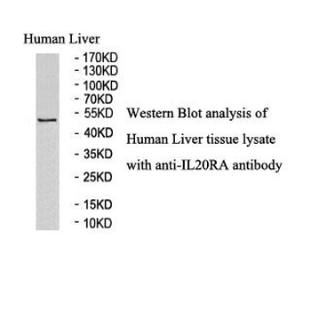 IL20RA Rabbit Polyclonal Antibody