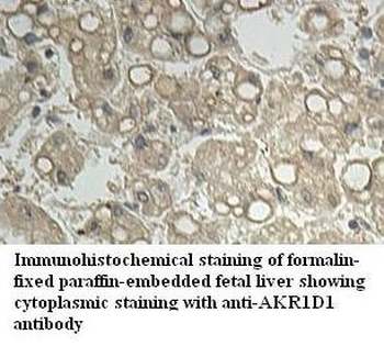 AKR1D1 Rabbit Polyclonal Antibody