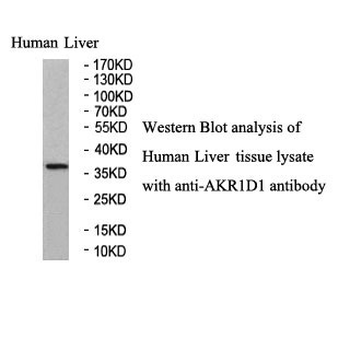 AKR1D1 Rabbit Polyclonal Antibody