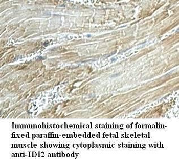 IDI2 Rabbit Polyclonal Antibody