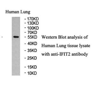 IFIT2 Rabbit Polyclonal Antibody