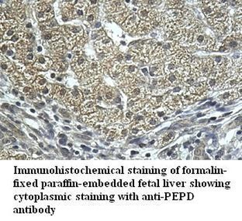 PEPD Rabbit Polyclonal Antibody