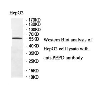 PEPD Rabbit Polyclonal Antibody
