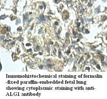 ALG1 Rabbit Polyclonal Antibody