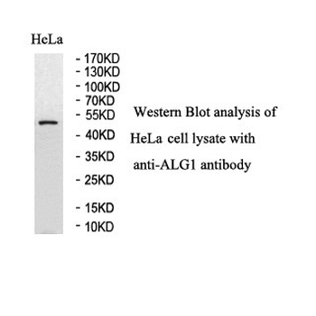 ALG1 Rabbit Polyclonal Antibody