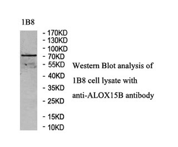 ALOX15B Rabbit Polyclonal Antibody