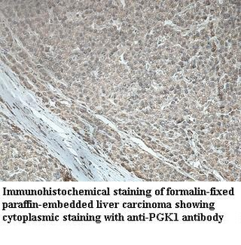 PGK1 Rabbit Polyclonal Antibody