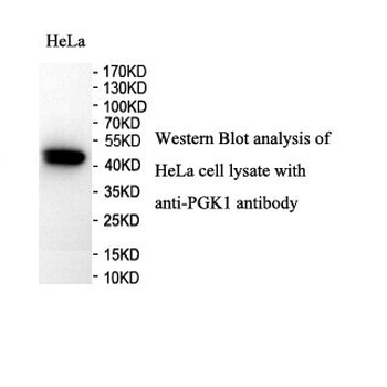 PGK1 Rabbit Polyclonal Antibody