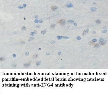 ING4 Rabbit Polyclonal Antibody