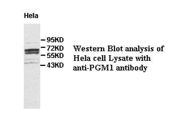PGM1 Rabbit Polyclonal Antibody