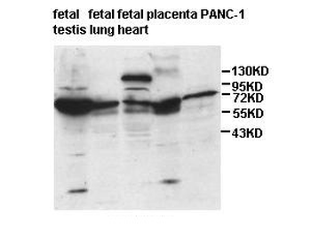 ISYNA1 Rabbit Polyclonal Antibody
