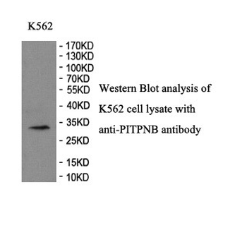 PITPNB Rabbit Polyclonal Antibody