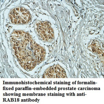RAB18 Rabbit Polyclonal Antibody