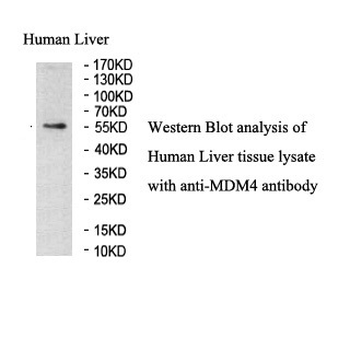 MDM4 Rabbit Polyclonal Antibody