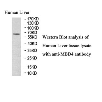 MBD4 Rabbit Polyclonal Antibody