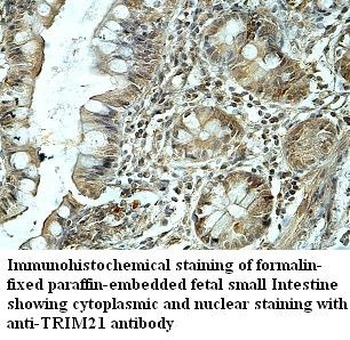 TRIM21 Rabbit Polyclonal Antibody