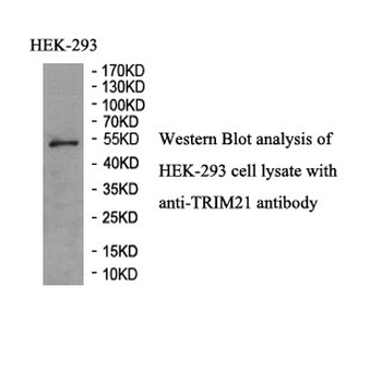 TRIM21 Rabbit Polyclonal Antibody