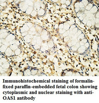 OAS1 Rabbit Polyclonal Antibody