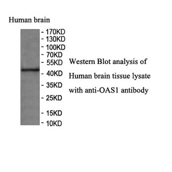 OAS1 Rabbit Polyclonal Antibody