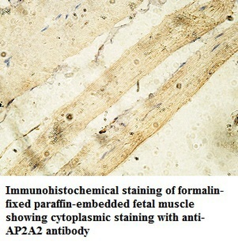 AP2B1 Rabbit Polyclonal Antibody